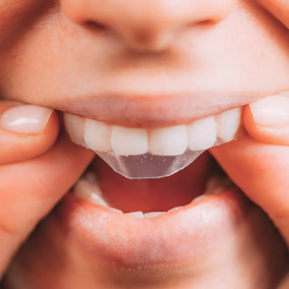 woman using whitening strips