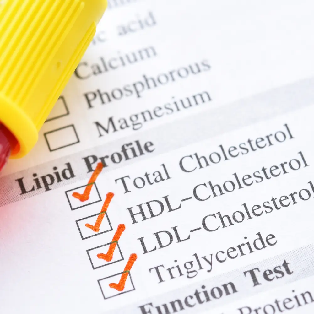 a doctor checklist on various lipid profile tests