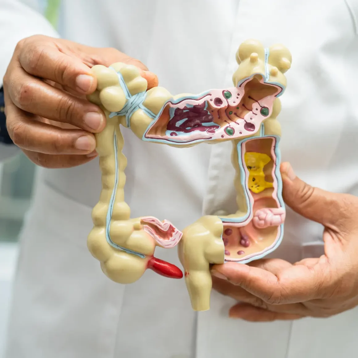 a doctor holding a model of the intestine